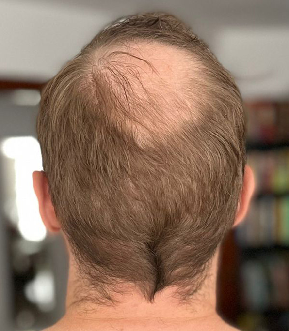 2022 09 15 back cropped